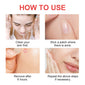 True Hydrocolloid Invisible Essential Oil Acne Patch